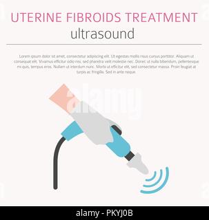 Uterusmyome. Ginecological medizinische Krankheit bei Frauen Infografik. Vector Illustration Stock Vektor