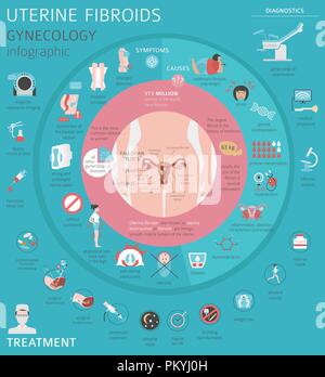 Uterusmyome. Ginecological medizinische Krankheit bei Frauen Infografik. Vector Illustration Stock Vektor