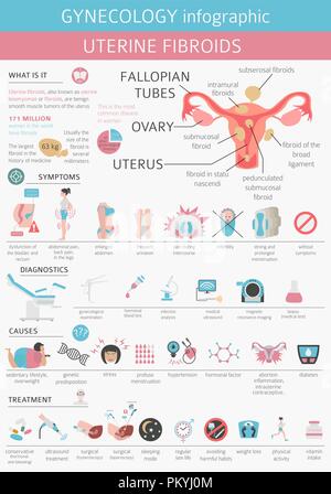 Uterusmyome. Ginecological medizinische Krankheit bei Frauen Infografik. Vector Illustration Stock Vektor