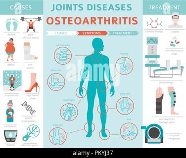 Gelenke Krankheiten. Arthritis, Arthrose Symptome, Behandlung Icon Set. Medizinische Infografik Design. Vector Illustration Stock Vektor