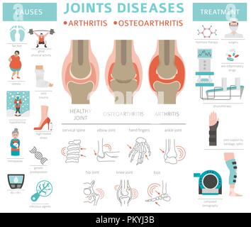 Gelenke Krankheiten. Arthritis, Arthrose Symptome, Behandlung Icon Set. Medizinische Infografik Design. Vector Illustration Stock Vektor