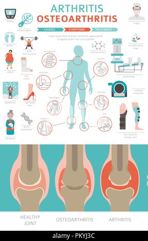 Gelenke Krankheiten. Arthritis, Arthrose Symptome, Behandlung Icon Set. Medizinische Infografik Design. Vector Illustration Stock Vektor