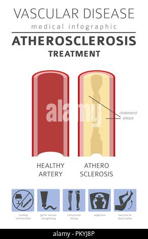 Gefäßerkrankungen. Arteriosklerose Symptome, Behandlung Icon Set. Medizinische Infografik Design. Vector Illustration Stock Vektor