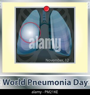 Symbol Lungenerkrankung. Die Atmung. Die atmungsorgane. Atemwegserkrankungen - Krebs, Asthma, Tuberkulose, Lungenentzündung. Welt Pneumonie Tag. Health Care. Röntgenaufnahme der Lunge Stock Vektor
