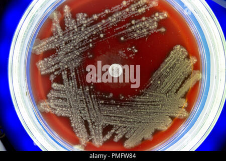 Petrischale mit Kolonien von Mikroben Stockfoto