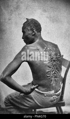 Narben eines Schlagsahne Mississippi Slave, Foto April 2, 1863, Baton Rouge, Louisiana, USA. Originale Bildunterschrift: "Aufseher Artayou Carrier mich geschlagen. Ich war zwei Monate im Bett wund vom treibend. Mein Meister kommen, nachdem ich geschlagen wurde; er Aufseher entlassen. Die Worte der armen Petrus, als er für seine Bild gesessen." Stockfoto