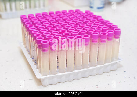 Leeren Sie das Blut, das Rohr im Labor Stockfoto