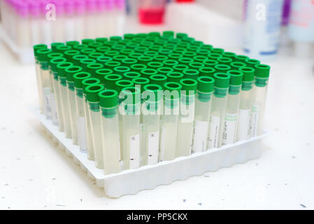 Leeren Sie das Blut, das Rohr im Labor Stockfoto