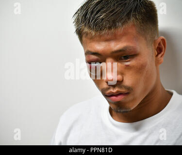 Nagoya, Aichi, Japan. 24 Sep, 2018. Sho Kimura (JPN) Boxen: Sho Kimura von Japan wird von der Presse nach dem Verlust des WBO Fliegengewicht Titelzeitraum bei Takeda Teva Ozean Arena in Nagoya, Aichi, Japan interviewt. Credit: Hiroaki Yamaguchi/LBA/Alamy leben Nachrichten Stockfoto