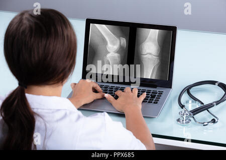 Ärztin untersuchen Knie X-ray auf dem Laptop in der Klinik Stockfoto