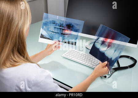Nahaufnahme einer weiblichen Zahnarzt auf Zähne X-ray In der Klinik Stockfoto
