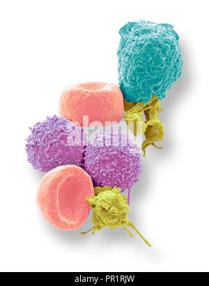 Blutzellen. Farbige Scanning Electron Micrograph (SEM) der menschlichen roten Blutkörperchen (Erythrozyten), weißen Blutkörperchen (Leukozyten, pink und Cyan) und der Blutplättchen (Thrombozyten, gelb). Die Scheibenförmigen, biconcave Erythrozyten transportieren Sauerstoff zu den Zellen des Körpers und Kohlendioxid in die Lunge zu entfernen. Leukozyten sind Teil des Immunsystems, die Verteidigung des Körpers gegen eine Infektion durch die Aufnahme von Pathogenen durch Phagozytose oder durch die Produktion von Antikörpern. Vergrößerung: x5000, wenn 10 Zentimeter hohe gedruckt. Stockfoto