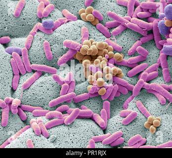 Farbige Scanning Electron Micrograph (SEM) von Bakterien gebildete aus einer Geschirrtuch. Geschirrtücher können haben sechs Mal so viele Bakterien als wc Griffe laut einigen Studien. Sie oft Hafen schädlichen E.coli Bakterien, die Diarrhöe, die in gefährdeten Menschen tödlich sein kann, verursachen kann. Viele Leute können ihre geschirrtuch auf einer ausreichend hohen Temperatur zu reinigen allgemein vorhanden Bakterien wie Campylobacter, Salmonellen, Staphylokokken, Escherichia coli, Listeria und töten. Vergrößerung: x6500 bei 10 cm Breite gedruckt. Stockfoto