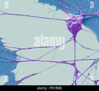 Stem Cell-derived Motor Neuron. Farbige Scanning Electron Micrograph (SEM) eines menschlichen Nervenzelle (Neuron), der sich aus einer embryonalen pluripotenten Stammzellen abgeleitet wurde (ES). Pluripotente Stammzellen sind in der Lage, in einem der 200 Zelltypen des menschlichen Körpers differenzieren. Die Art der Zelle, die sie zu reifen hängt von der biochemischen Signalen von der unreifen Zellen erhalten. Diese Fähigkeit macht sie eine potentielle Quelle von Zellen beschädigtes Gewebe in Krankheiten wie Parkinson und Insulin-abhängigen Diabetes zu reparieren. Vergrößerung: x1500, wenn gedruckt 10 Zentimeter in der Breite Stockfoto