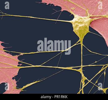 Stem Cell-derived Motor Neuron. Farbige Scanning Electron Micrograph (SEM) eines menschlichen Nervenzelle (Neuron), der sich aus einer embryonalen pluripotenten Stammzellen abgeleitet wurde (ES). Pluripotente Stammzellen sind in der Lage, in einem der 200 Zelltypen des menschlichen Körpers differenzieren. Die Art der Zelle, die sie zu reifen hängt von der biochemischen Signalen von der unreifen Zellen erhalten. Diese Fähigkeit macht sie eine potentielle Quelle von Zellen beschädigtes Gewebe in Krankheiten wie Parkinson und Insulin-abhängigen Diabetes zu reparieren. Vergrößerung: x1500, wenn 10 Zentimeter Breite gedruckt. Stockfoto