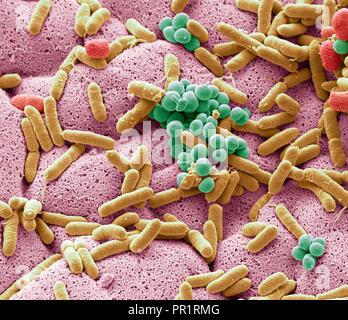 Farbige Scanning Electron Micrograph (SEM) von Bakterien gebildete aus einer Geschirrtuch. Geschirrtücher können haben sechs Mal so viele Bakterien als wc Griffe laut einigen Studien. Sie oft Hafen schädlichen E.coli Bakterien, die Diarrhöe, die in gefährdeten Menschen tödlich sein kann, verursachen kann. Viele Leute können ihre geschirrtuch auf einer ausreichend hohen Temperatur zu reinigen allgemein vorhanden Bakterien wie Campylobacter, Salmonellen, Staphylokokken, Escherichia coli, Listeria und töten. Vergrößerung: x6500 bei 10 cm Breite gedruckt. Stockfoto