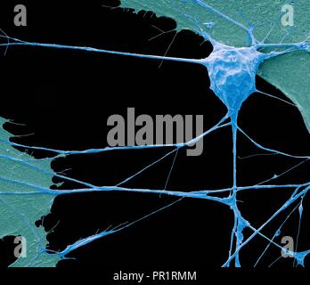 Stem Cell-derived Motor Neuron. Farbige Scanning Electron Micrograph (SEM) eines menschlichen Nervenzelle (Neuron), der sich aus einer embryonalen pluripotenten Stammzellen abgeleitet wurde (ES). Pluripotente Stammzellen sind in der Lage, in einem der 200 Zelltypen des menschlichen Körpers differenzieren. Die Art der Zelle, die sie zu reifen hängt von der biochemischen Signalen von der unreifen Zellen erhalten. Diese Fähigkeit macht sie eine potentielle Quelle von Zellen beschädigtes Gewebe in Krankheiten wie Parkinson und Insulin-abhängigen Diabetes zu reparieren. Vergrößerung: x1500, wenn 10 Zentimeter Breite gedruckt. Stockfoto