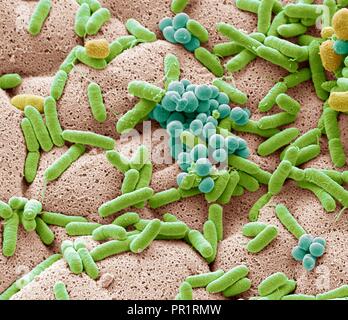 Farbige Scanning Electron Micrograph (SEM) von Bakterien gebildete aus einer Geschirrtuch. Geschirrtücher können haben sechs Mal so viele Bakterien als wc Griffe laut einigen Studien. Sie oft Hafen schädlichen E.coli Bakterien, die Diarrhöe, die in gefährdeten Menschen tödlich sein kann, verursachen kann. Viele Leute können ihre geschirrtuch auf einer ausreichend hohen Temperatur zu reinigen allgemein vorhanden Bakterien wie Campylobacter, Salmonellen, Staphylokokken, Escherichia coli, Listeria und töten. Vergrößerung: x6500 bei 10 cm Breite gedruckt Stockfoto