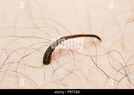 Tropische land Leech/Backen land Leech (Haemadipsa sp.) saugen Blut von der menschlichen Haut. (Aus Thailand, Südostasien) Stockfoto