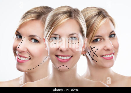 Mehrfachbelichtung der Glückliche junge Frau mit Korrektur Linien auf Ihrem Gesicht Stockfoto