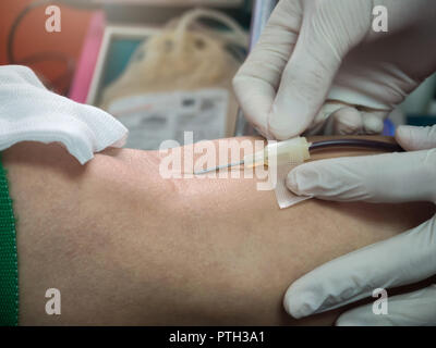 Krankenschwester erstechen medizinische Nadeln zu Spender arm. Blutspender, die Spende im Krankenhaus. Stockfoto