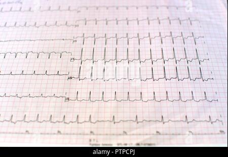 Nahaufnahme eines Elektrokardiogramms in gedruckter Form für Gesundheitswesen und medizinische Konzept. EKG oder EKG-Papier Hintergrund, von vorne gesehen Stockfoto