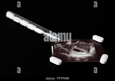 Uzi geschossen, Pillen und Reagenzglas auf schwarzem Hintergrund, Abtreibung, close-up Stockfoto