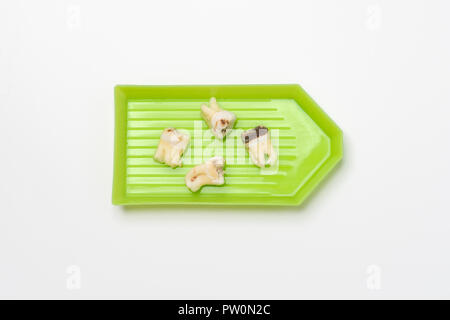 Herausgezogen schlecht Molaren menschlichen Zähnen bis auf weißem Hintergrund schließen Stockfoto