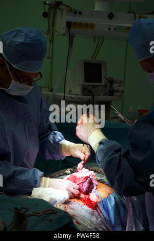 Chirurgische Eingriffe bei der Geburt im Krankenhaus, Kaiserschnitt, Tschechische Republik Stockfoto