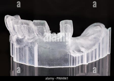 Das System der Implantate auf schwarzem Hintergrund Stockfoto