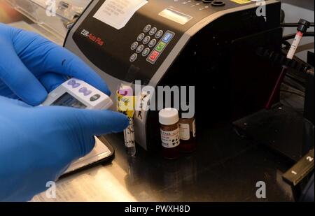 Us Air Force Airman 1st Class Austin Sanders, 88th Diagnostika und Therapeutika Squadron klinisches Labor Phase 2 Student, mal ein Blut Rotator in der Hämatologie Labor an der Wright-Patterson Air Force Base Medical Center, 26. Juni 2017. Das Blut Rotator hält effektiv biologische Proben in ständiger Bewegung ist, dass die Probe gründlich gemischt und für die Prüfung geeignet. Stockfoto
