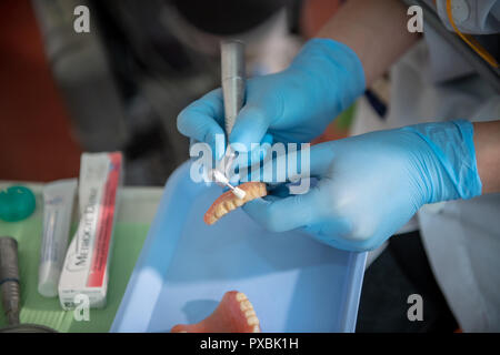 Dental Assistant manuell reinigen alten Zahnersatz von Hand Stockfoto