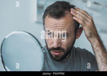 Umgekippt im mittleren Alter Mann mit Alopezie im Spiegel zu betrachten, Haarausfall Konzept Stockfoto