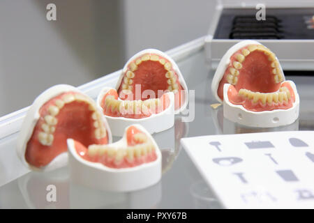 Zahnersatz. Künstliche menschliche Kiefer mit Zähnen. Stockfoto