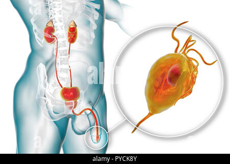 Trichomoniasis, Illustration. Computer Bild der männlichen Geschlechtsorgane und die parasitäre Mikroorganismen Trichomonas vaginalis, dem Erreger der trichomoniasis. Trichomoniasis ist eine häufige Ursache von Urethritis, Prostatitis und ist eine sexuell übertragene Krankheit. Stockfoto