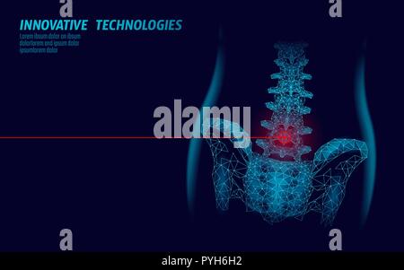 Die menschliche Wirbelsäule Hüfte lumbale Radikulitis Schmerz Low Poly. Geometrische vieleckige Partikelfilter Dreieck Point Line die zukünftige Medizin Technologie blau rot schmerzlichen Bereich Vector Illustration Stock Vektor