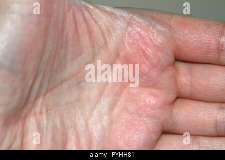Stock shot: Nahaufnahme der Handfläche eines weißen Mannes Stockfoto