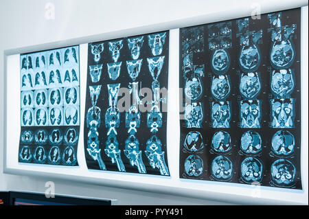 Mehrere Magnetresonanztomographie (MRT) des Gehirns. Selektiver Fokus Stockfoto