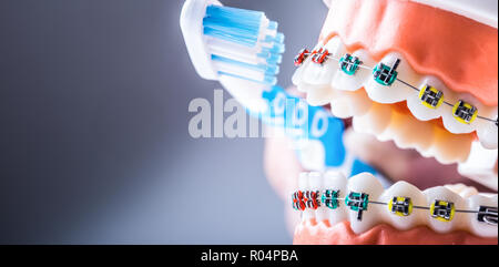Close-up Zähne Klammern und zahnbürste als Beispiel für Zähneputzen. Stockfoto