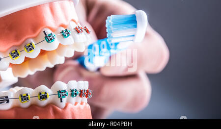 Close-up Zähne Klammern und zahnbürste als Beispiel für Zähneputzen. Stockfoto