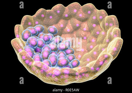 Blastozyste, computer Abbildung. Eine Blastozyste ist eine hohle Kugel von Zellen mit einer Flüssigkeit Zentrum gebildet, nachdem mehrere Abteilungen eines befruchteten Zelle (Zygote). Die innere Zellmasse (lila) enthält die Zellen, die Form wird der Embryo selbst, die embryonale Stammzellen (WSR). Stockfoto