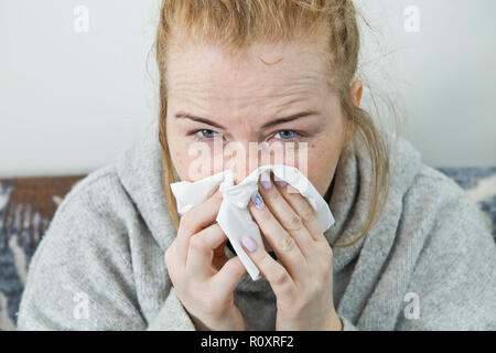 Kranke Frau. Niesen in Gewebe. Kopfschmerzen. Virus. Arzneimittel Stockfoto