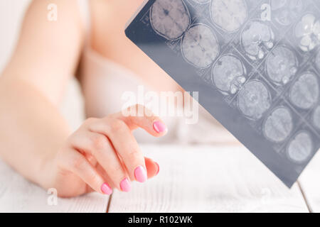 Frau Hand MRI Gehirn Film für Diagnose- und Bericht zu sehen. Medizinisches Konzept Stockfoto