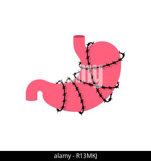 Magen und Stacheldraht. Sick innere Organe Anatomie des Menschen. Metapher der Probleme und der Verringerung von. Schmerzen Medical Health Care Concept Stock Vektor