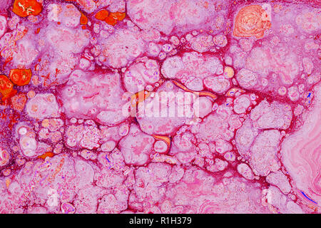 Nahaufnahme der Oberfläche mit Säure Tinte Flecken und Blasen. Heat Map, chemische Reaktion. Stockfoto