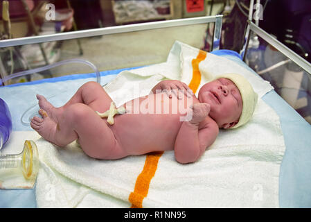 Ein neugeborenes Baby in den Operationssaal gerade nach einem Kaiserschnitt gereinigt Stockfoto