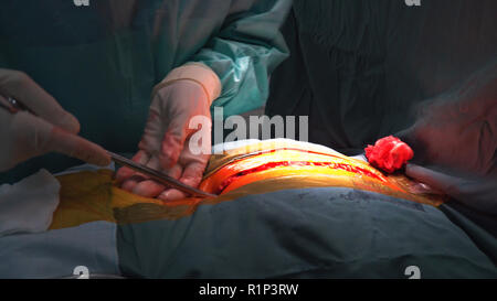 Team Chirurgen bei der Arbeit im Operationssaal. Op-Leuchte im Operationssaal. Vorbereitung für den Beginn der chirurgischen Eingriff mit einem Schnitt. Stockfoto