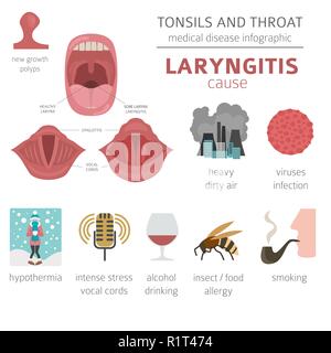 Mandeln HNO-Krankheiten. Laryngitis Symptome, Behandlung Icon Set. Medizinische Infografik Design. Vector Illustration Stock Vektor