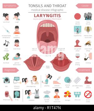 Mandeln HNO-Krankheiten. Laryngitis Symptome, Behandlung Icon Set. Medizinische Infografik Design. Vector Illustration Stock Vektor