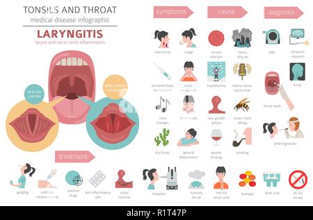 Mandeln HNO-Krankheiten. Laryngitis Symptome, Behandlung Icon Set. Medizinische Infografik Design. Vector Illustration Stock Vektor